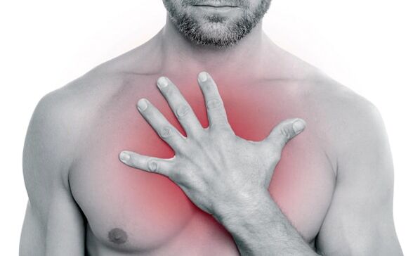 Ból w klatce piersiowej w osteochondrozie klatki piersiowej