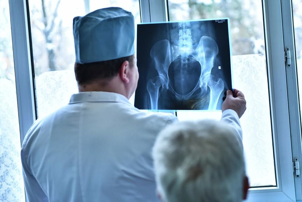 Lekarz patrzy na zdjęcie stawu biodrowego z artrozą